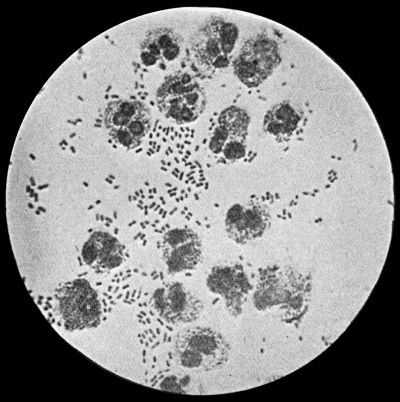 Fig. 4.—Bacillus coli communis in Urine, from a case of Cystitis. × 1000 diam. Leishman's stain.
