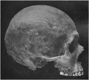 Plate 7b: Profile