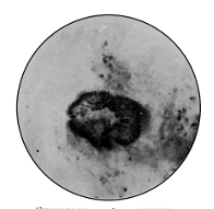 Streptothrix Actinomyces