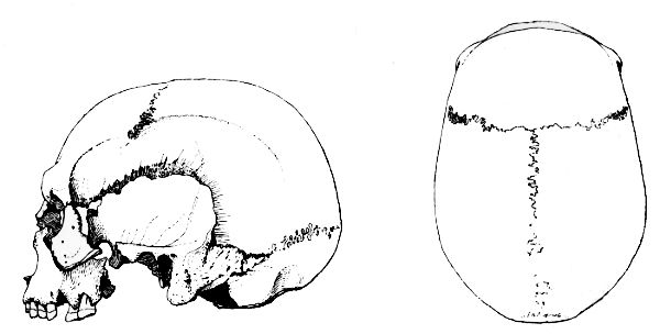 Skull